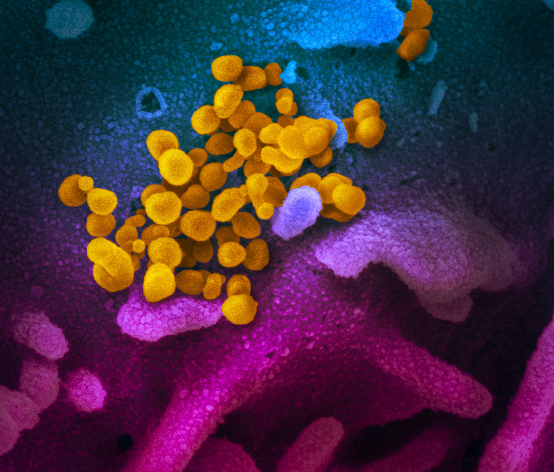Dépistage général des personnes venant des États-Unis et de l’Asie de l’Est souffrant des problèmes respiratoires